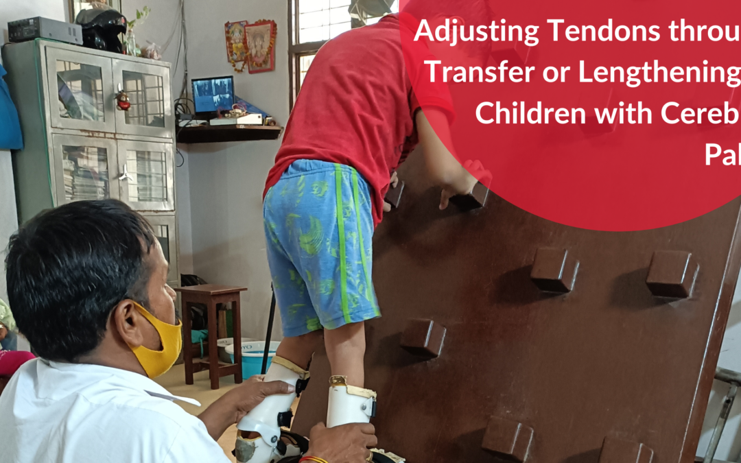 Adjusting Tendons through Transfer or Lengthening in Children with Cerebral Palsy