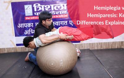 Hemiplegia vs. Hemiparesis: Key Differences Explained